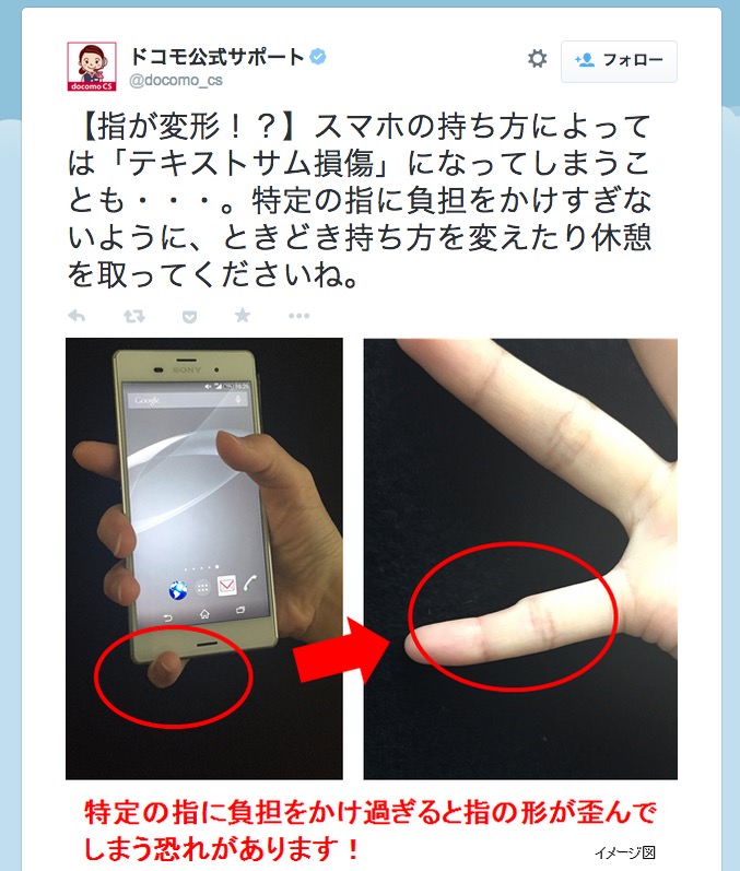 スマホの持ち方で指が変形？ドコモ公式がTwitterで注意喚起