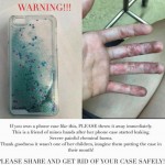 【注意】液体入りのiPhoneケース(キラキラケース)で事故多発!液体が漏れて化学熱傷の被害