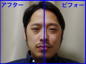 37歳男性が美顔器(Re;Born+)を試したら顔がシュッとして肌がモチっとした話【PR】